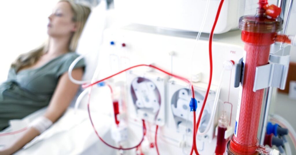 Kidney Dialysis Understanding the 5 Stages of Chronic Kidney Disease